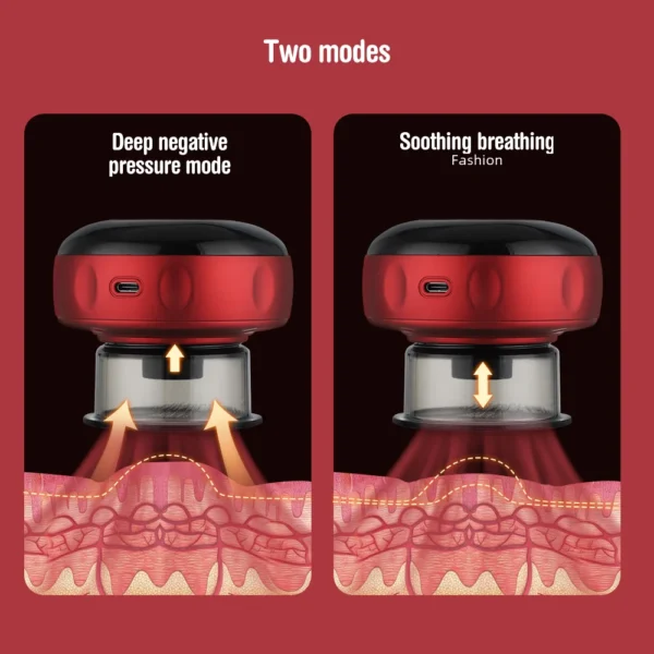 Intelligent Vacuum Cupping Massage Device Electric Heating Scraping Suction Cups Physical Fatigue Relieve Health Guasha Cans - Image 3
