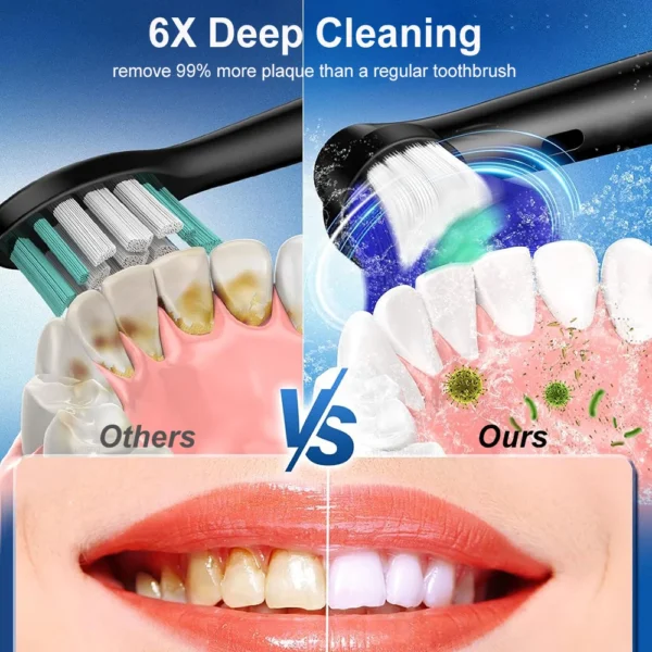 Electric Rotating Toothbrush Deep Clean Whitening Teeth for Adult Ultrasonic Toothbrush with 4/8pcs Refill Replacement Heads - Image 4