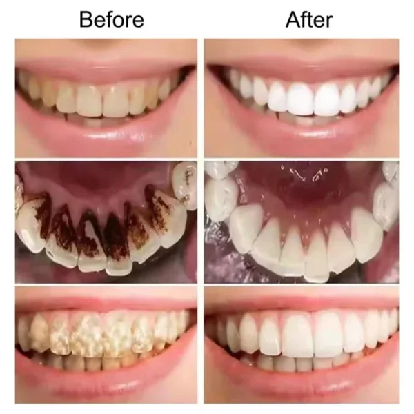 V34 Purple Teeth Whitening Toothpaste Remove Plaque Stains Cleaning Oral Hygiene Dental Bleach Tools Fresh Breath Beauty Health - Image 2