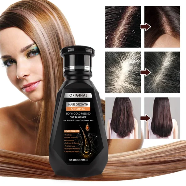 2pcs/set Hair Growth Essential Oil Biotin Cold-Pressed DHT Blocker and Hair Growth Shampoo Anti-Hair Loss Conditioner - Image 5