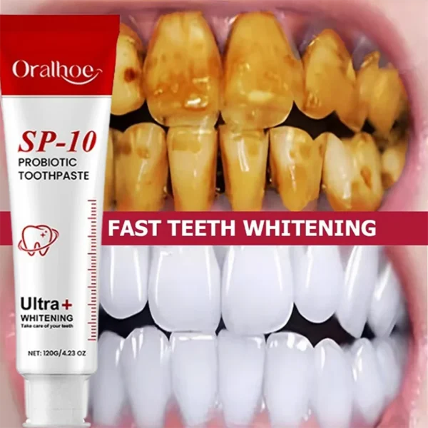 120g SP-10 Probiotic Toothpaste Remove Plaque Stains Whiten Tooth Fresh Breath Oral Hygiene Clean Teeth Care Management Product