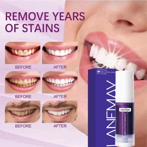 V34 Purple Teeth Whitening Toothpaste Remove Plaque Stains Cleaning Oral Hygiene Dental Bleach Tools Fresh Breath Beauty Health - Image 3